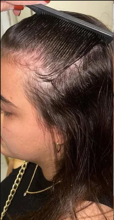 Raya del cabello de una clienta antes de empezar la rutina de fortalecimiento DePaw